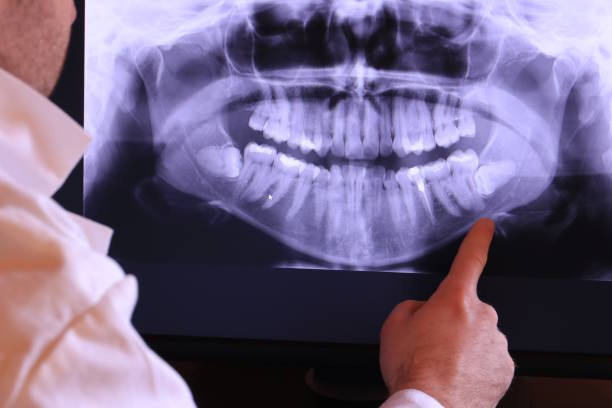 Best Mobile Emergency Dentist in Bushland, TX