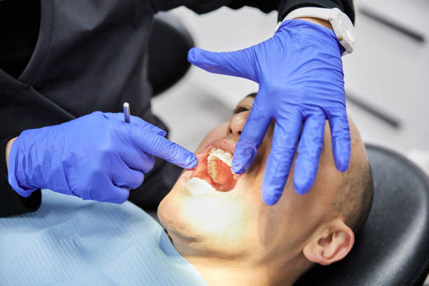 Best Emergency Dental Extractions in Bushland, TX