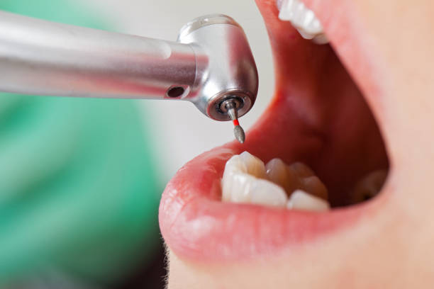 Best Pediatric Emergency Dentist in Bushland, TX